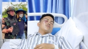文拉妮夫人派代表慰问在边境冲突中眼部受伤士兵