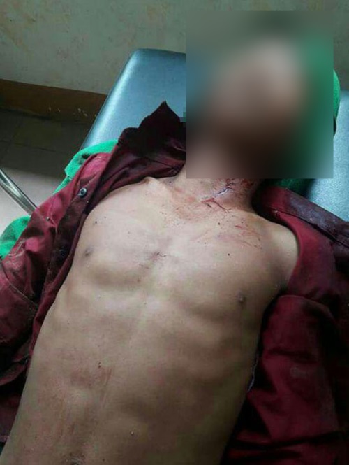受伤的11岁男童在医院疗伤。 （柬埔寨星洲日报）