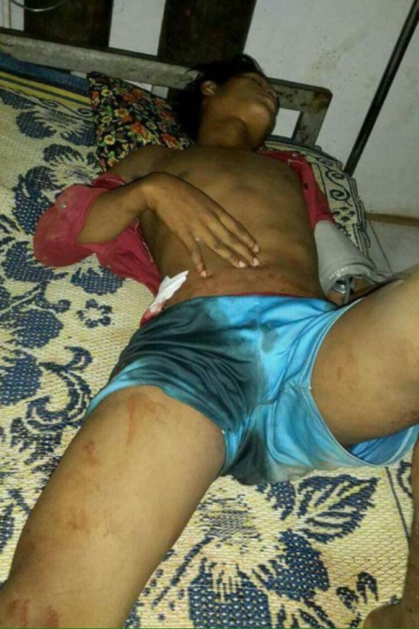 青年男子遭枪手开枪攻击受重伤。