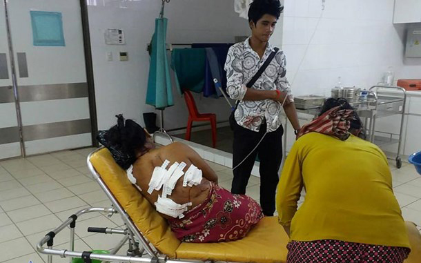 妇女的背部被丈夫砍伤。