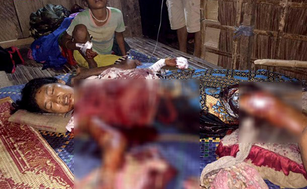 妇女晚上睡觉时突遭丈夫砍伤。