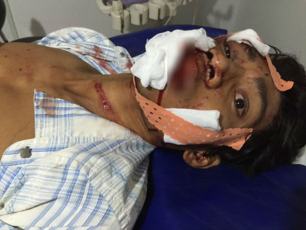 建筑工人在医院接受治疗。