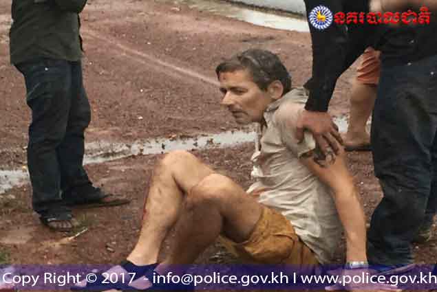 图为其中一名受伤的外国人。