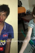 成功了不算什么，失败时就被打残！一名抢包包的盗贼被人家逮住打残！ ...