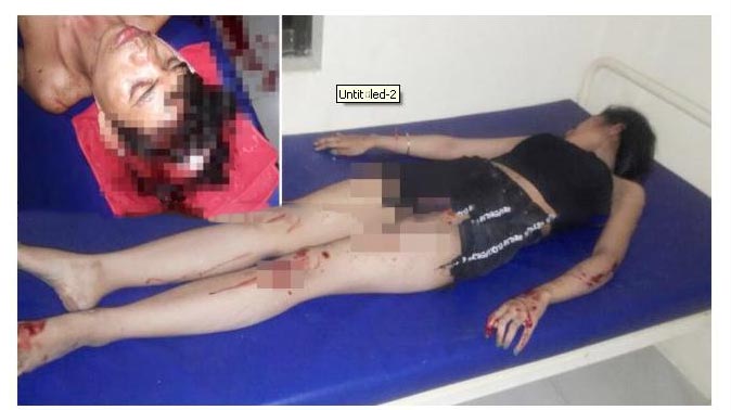 图为两名事主在医院疗伤。 （图：柬埔寨星洲日报）