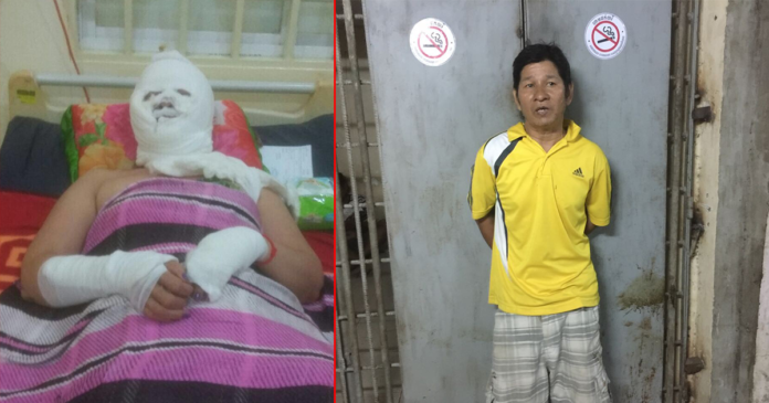 男子涉嫌以硫酸攻击妇女。