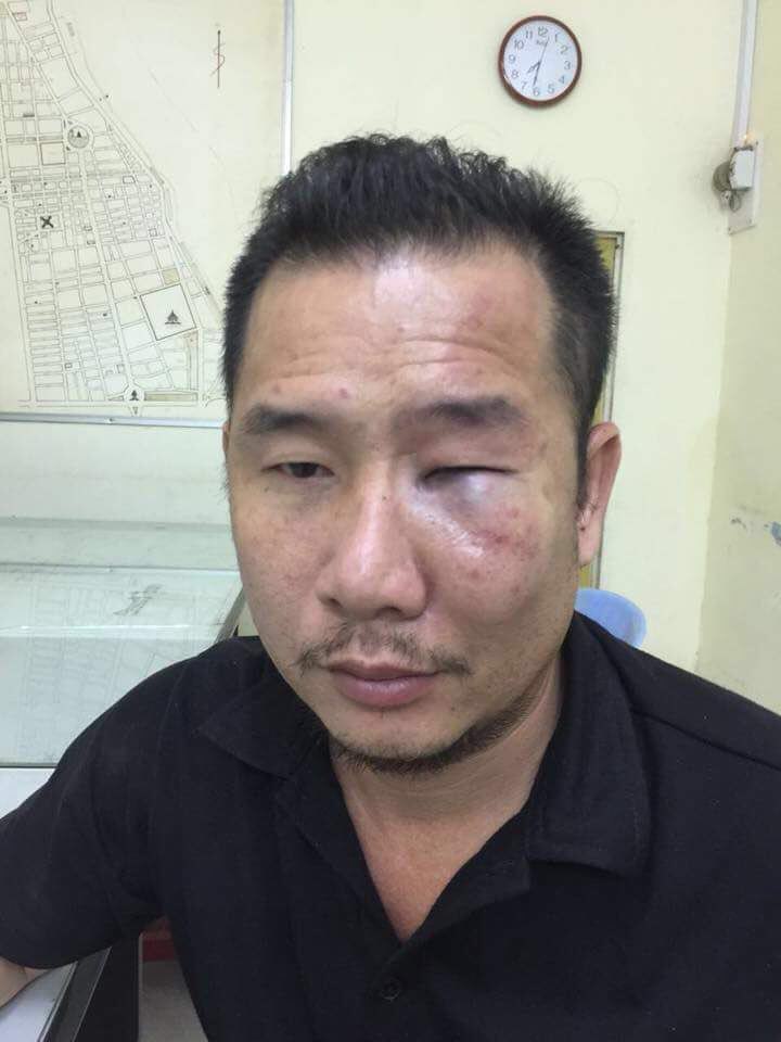 挨打的车伕。